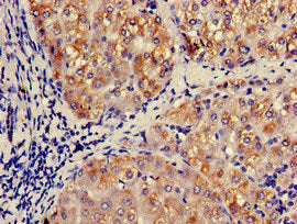 Immunohistochemistry of paraffin-embedded human liver tissue using CCL3 Antibody at dilution of 1:100Rabbit anti-Human CCL3 Polyclonal Antibody