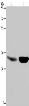 Gel: 8%SDS-PAGE, Lysate: 40 μg, Lane 1-2: Human fetal brain tissue, mouse brain tissue, Primary antibody: MAPRE3 Antibody(MAPRE3 Antibody) at dilution 1/500, Secondary antibody: Goat anti rabbit IgG at 1/8000 dilution, Exposure time: 5 seconds
