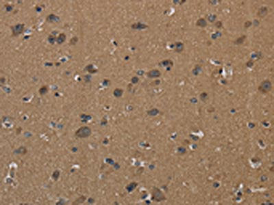 The image on the left is immunohistochemistry of paraffin-embedded Human brain  tissue using ICAM4 Antibody(ICAM4 Antibody) at dilution 1/50, on the right is treated with fusion protein. (Original magnification: ×200)Rabbit anti-Human ICAM4 Polyclonal Antibody