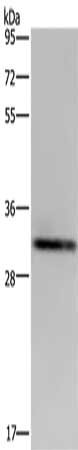 Gel: 10%SDS-PAGE, Lysate: 40 μg, Lane: OP9 cells, Primary antibody: ICAM4 Antibody(ICAM4 Antibody) at dilution 1/500, Secondary antibody: Goat anti rabbit IgG at 1/8000 dilution, Exposure time: 30 secondsRabbit anti-Human ICAM4 Polyclonal Antibody