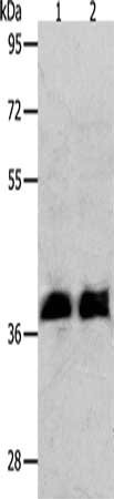 Gel: 10%SDS-PAGE, Lysate: 40 μg, Lane 1-2: Jurkat cells, K562 cells, Primary antibody: RNF126 Antibody(RNF126 Antibody) at dilution 1/350, Secondary antibody: Goat anti rabbit IgG at 1/8000 dilution, Exposure time: 20 secondsRabbit anti-Human RNF126 Polyclonal Antibody