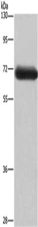 Gel: 8%SDS-PAGE, Lysate: 40 μg, Lane: Mouse brain tissue, Primary antibody: DPYSL3 Antibody(DPYSL3 Antibody) at dilution 1/350, Secondary antibody: Goat anti rabbit IgG at 1/8000 dilution, Exposure time: 30 secondsRabbit anti-Human DPYSL3 Polyclonal Antibody