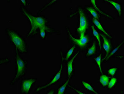 Immunofluorescence staining of Hela cells with CLU Antibody at 1:66, counter-stained with DAPI. The cells were fixed in 4% formaldehyde, permeabilized using 0.2% Triton X-100 and blocked in 10% normal Goat Serum. The cells were then incubated with the antibody overnight at 4°C. The secondary antibody was Alexa Fluor 488-congugated AffiniPure Goat Anti-Rabbit IgG(H+L).Rabbit anti-Human CLU Polyclonal Antibody