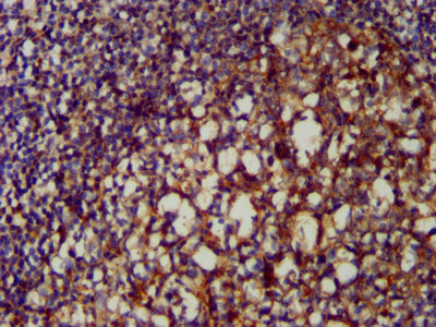 IHC image of CLU Antibody diluted at 1:200 and staining in paraffin-embedded human tonsil tissue performed on a Leica BondTM system. After dewaxing and hydration, antigen retrieval was mediated by high pressure in a citrate buffer (pH 6.0). Section was blocked with 10% normal goat serum 30min at RT. Then primary antibody (1% BSA) was incubated at 4°C overnight. The primary is detected by a biotinylated secondary antibody and visualized using an HRP conjugated SP system.Rabbit anti-Human CLU Polyclonal Antibody