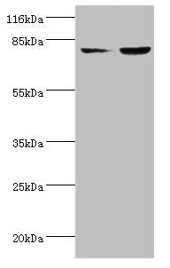 Western blot  | All lanes: ACSL4 antibody at 2µg/ml  | Lane 1: HepG2 whole cell lysate  | Lane 2: Hela whole cell lysate  | Secondary  | Goat polyclonal to rabbit IgG at 1/10000 dilution  | Predicted band size: 80, 75 kDa  | Observed band size: 80 kDa
