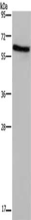 Gel: 10%SDS-PAGE, Lysate: 40 μg, Lane: Human placenta tissue, Primary antibody: ART4 Antibody(ART4 Antibody) at dilution 1/1000, Secondary antibody: Goat anti rabbit IgG at 1/8000 dilution, Exposure time: 2 minutesRabbit anti-Human ART4 Polyclonal Antibody