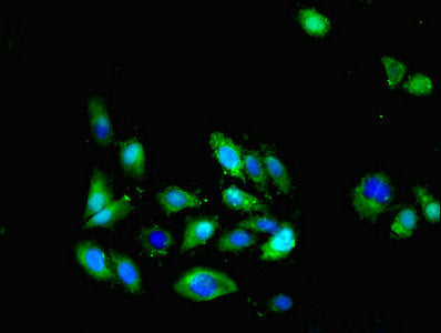 Immunofluorescent analysis of Hela cells cells using CX3CL1 Antibody at dilution of 1:100 and Alexa Fluor 488-congugated AffiniPure Goat Anti-Rabbit IgG(H+L)Rabbit anti-Human CX3CL1 Polyclonal Antibody