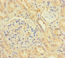 Immunohistochemistry of paraffin-embedded human kidney tissue using the antibody at dilution of 1:100Rabbit anti-Human CX3CL1 Polyclonal Antibody
