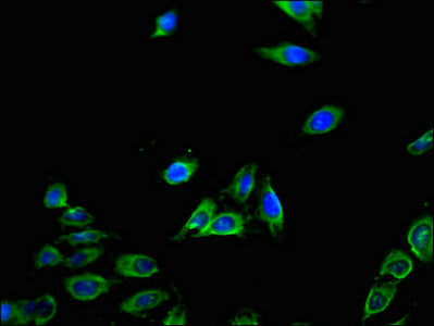 Immunofluorescent analysis of Hela cells using CXCL11 Antibody at dilution of 1:100 and Alexa Fluor 488-congugated AffiniPure Goat Anti-Rabbit IgG(H+L)
