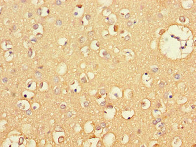 Immunohistochemistry of paraffin-embedded human brain tissue using the antibody at dilution of 1:100