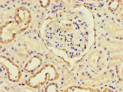 Immunohistochemistry of paraffin-embedded human kidney tissue using CXCL11 Antibody at dilution of 1:100