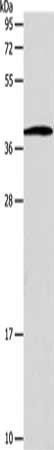 Gel: 12%SDS-PAGE, Lysate: 40 μg, Lane: Human lymphoma tissue, Primary antibody: SLC25A11 Antibody(SLC25A11 Antibody) at dilution 1/600, Secondary antibody: Goat anti rabbit IgG at 1/8000 dilution, Exposure time: 20 secondsRabbit anti-Human SLC25A11 Polyclonal Antibody
