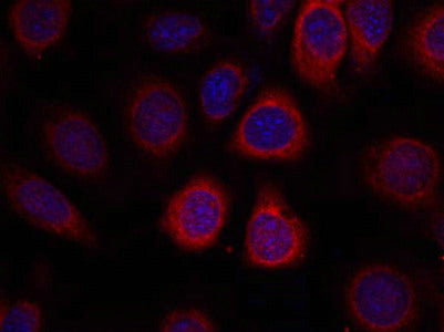 Immunofluorescence staining of methanol-fixed MCF7 cells using S6 Ribosomal Protein(Ab-235) Antibody.Rabbit anti-Human RPS6 Polyclonal Antibody