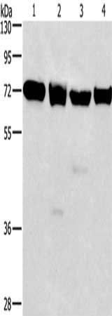 Gel: 10%SDS-PAGE, Lysate: 40 μg, Lane 1-4: 231 cells, 293T cells, Raji cells, hela cells, Primary antibody: IL2RB Antibody(IL2RB Antibody) at dilution 1/325, Secondary antibody: Goat anti rabbit IgG at 1/8000 dilution, Exposure time: 20 secondsRabbit anti-Human IL2RB Polyclonal Antibody