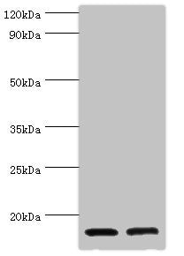 Western blot  | All lanes: CST3 antibody at 2µg/ml  | Lane 1: High values of serum at 1: 10  | Lane 2: High values of serum at 1: 100  | Secondary  | Goat polyclonal to rabbit IgG at 1/10000 dilution  | Predicted band size: 16 kDa  | Observed band size: 16 kDaRabbit anti-Human CST3 Polyclonal Antibody