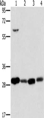 Gel: 8%SDS-PAGE, Lysate: 40 μg, Lane 1-4: 293T cells, human testis tissue, A375 cells, human normal kidney tissue, Primary antibody: MRPL28 Antibody(MRPL28 Antibody) at dilution 1/600, Secondary antibody: Goat anti rabbit IgG at 1/8000 dilution, Exposure time: 2 secondsRabbit anti-Human MRPL28 Polyclonal Antibody