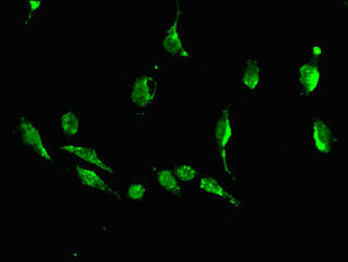 Immunofluorescent analysis of U251 cells using DKK1 Antibody at dilution of 1:100 and Alexa Fluor 488-congugated AffiniPure Goat Anti-Rabbit IgG(H+L)Rabbit anti-Human DKK1 Polyclonal Antibody