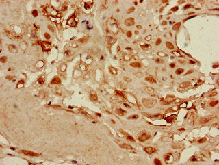 Immunohistochemistry of paraffin-embedded human placenta tissue using the antibody at dilution of 1:100Rabbit anti-Human DKK1 Polyclonal Antibody