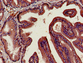Immunohistochemistry of paraffin-embedded human prostate tissue using DPP4 Antibody at dilution of 1:100Rabbit anti-Human DPP4 Polyclonal Antibody