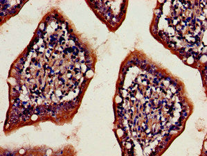 Immunohistochemistry of paraffin-embedded human small intestine tissue using DPP4 Antibody at dilution of 1:100Rabbit anti-Human DPP4 Polyclonal Antibody