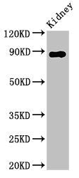 Western Blot | Positive WB detected in: Rat kidney tissue | All lanes: DPP4 antibody at 2.8μg/ml | Secondary | Goat polyclonal to rabbit IgG at 1/50000 dilution | Predicted band size: 89 kDa | Observed band size: 89 kDaRabbit anti-Human DPP4 Polyclonal Antibody