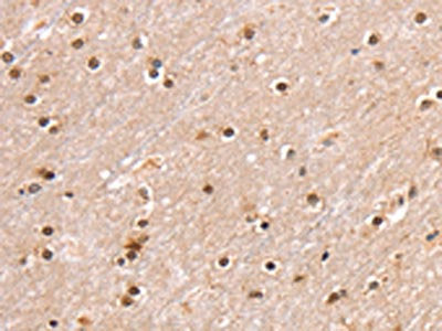The image on the left is immunohistochemistry of paraffin-embedded Human brain  tissue using SMARCB1 Antibody(SMARCB1 Antibody) at dilution 1/30, on the right is treated with fusion protein. (Original magnification: ×200)Rabbit anti-Human SMARCB1 Polyclonal Antibody