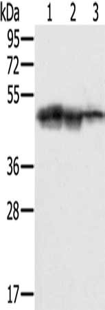 Gel: 8%SDS-PAGE, Lysate: 40 μg, Lane 1-3: Hepg2 cells, K562 cells, Jurkat cells, Primary antibody: SMARCB1 Antibody(SMARCB1 Antibody) at dilution 1/400, Secondary antibody: Goat anti rabbit IgG at 1/8000 dilution, Exposure time: 10 secondsRabbit anti-Human SMARCB1 Polyclonal Antibody