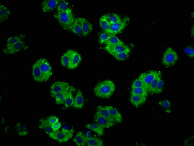 Immunofluorescence staining of HepG2 cells with CDH1 Antibody at 1:100, counter-stained with DAPI. The cells were fixed in 4% formaldehyde, permeabilized using 0.2% Triton X-100 and blocked in 10% normal Goat Serum. The cells were then incubated with the antibody overnight at 4°C. The secondary antibody was Alexa Fluor 488-congugated AffiniPure Goat Anti-Rabbit IgG(H+L).Rabbit anti-Human CDH1 Polyclonal Antibody