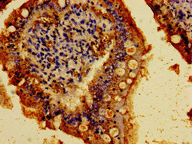 Immunohistochemistry of paraffin-embedded human small intestine tissue using CDH1 Antibody at dilution of 1:100Rabbit anti-Human CDH1 Polyclonal Antibody