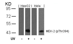 Western blot analysis of extracts from HepG2 and Hela cells untreated or treated with UV using MEK-2(Phospho-Thr394) Antibody.