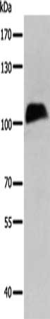 Gel: 8%SDS-PAGE, Lysate: 40 μg, Lane: PC3 cells, Primary antibody: CTBP2 Antibody(CTBP2 Antibody) at dilution 1/300, Secondary antibody: Goat anti rabbit IgG at 1/8000 dilution, Exposure time: 2 minutesRabbit anti-Human CTBP2 Polyclonal Antibody