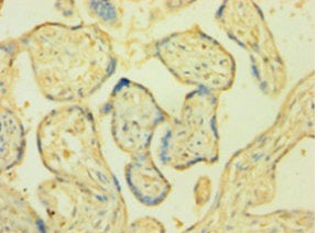 Immunohistochemistry of paraffin-embedded human placenta tissue using POR Antibody at dilution of 1:100