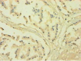 Immunohistochemistry of paraffin-embedded human prostate tissue using POR Antibody at dilution of 1:100