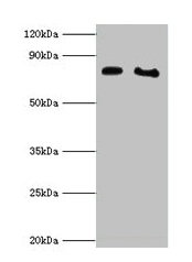 Western blot  | All lanes: POR antibody at 2µg/ml  | Lane 1: K562 whole cell lysate  | Lane 2: A431 whole cell lysate  | Secondary  | Goat polyclonal to rabbit IgG at 1/10000 dilution  | Predicted band size: 77 kDa  | Observed band size: 77 kDa