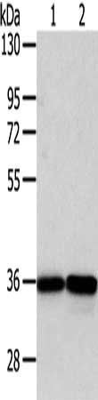 Gel: 8%SDS-PAGE, Lysate: 40 μg, Lane 1-2: PC3 and A375 cell, Primary antibody: WDR5 Antibody(WDR5 Antibody) at dilution 1/350 dilution, Secondary antibody: Goat anti rabbit IgG at 1/8000 dilution, Exposure time: 5 secondsRabbit anti-Human WDR5 Polyclonal Antibody