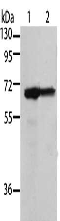 Gel: 10%SDS-PAGE, Lysate: 40 μg, Lane 1-2: 293T cells, A431 cells, Primary antibody: MSN Antibody(MSN Antibody) at dilution 1/500, Secondary antibody: Goat anti rabbit IgG at 1/8000 dilution, Exposure time: 1 minuteRabbit anti-Human MSN Polyclonal Antibody