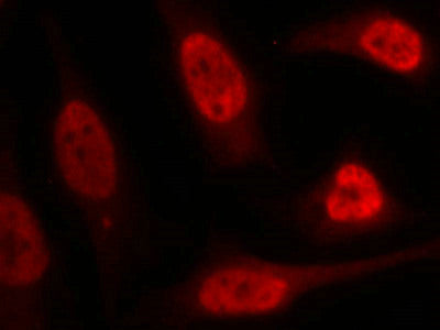 Immunofluorescence staining of methanol-fixed Hela cells using p53(Ab-15) Antibody.Rabbit anti-Human TP53 Polyclonal Antibody