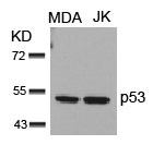Western blot analysis of extracts from MDA and JK cells using p53(Ab-15) Antibody.Rabbit anti-Human TP53 Polyclonal Antibody