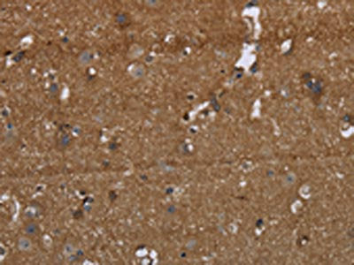 The image on the left is immunohistochemistry of paraffin-embedded Human brain  tissue using GALT Antibody(GALT Antibody) at dilution 1/40, on the right is treated with fusion protein. (Original magnification: ×200)Rabbit anti-Human GALT Polyclonal Antibody