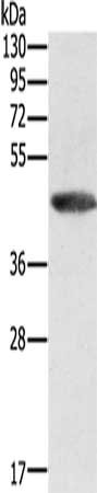 Gel: 8%SDS-PAGE, Lysate: 50 μg, Lane: Human fetal liver tissue, Primary antibody: GALT Antibody(GALT Antibody) at dilution 1/200, Secondary antibody: Goat anti rabbit IgG at 1/8000 dilution, Exposure time: 1 minuteRabbit anti-Human GALT Polyclonal Antibody