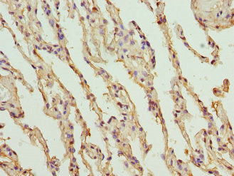 Immunohistochemistry of paraffin-embedded human lung tissue using the antibody at dilution of 1:100Rabbit anti-Human PROCR Polyclonal Antibody