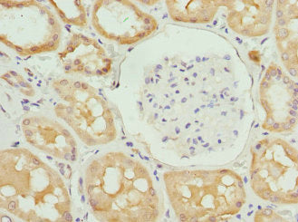 Immunohistochemistry of paraffin-embedded human kidney tissue using PROCR Antibody at dilution of 1:100Rabbit anti-Human PROCR Polyclonal Antibody