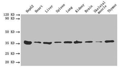 Western blot  | All lanes: ANXA5 antibody at 2µg/ml  | Lane 1: HepG2 whole cell lysate  | Lane 2: Mouse heart tissue  | Lane 3: Mouse liver tissue  | Lane 4: Mouse spleen tissue  | Lane 5: Mouse lung tissue  | Lane 6: Mouse kidney tissue  | Lane 7: Mouse brain tissue  | Lane 8: Mouse skeletal muscle tissue  | Lane 9: Mouse thymus tissue  | Secondary  | Goat polyclonal to rabbit IgG at 1/10000 dilution  | Predicted band size: 36 kDa  | Observed band size: 36 kDa
