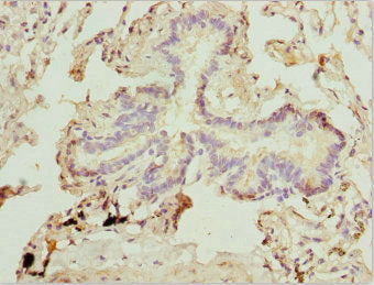 Immunohistochemistry of paraffin-embedded human lung tissue using ZFYVE1 Antibody at dilution of 1:100