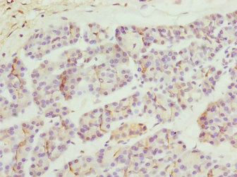 Immunohistochemistry of paraffin-embedded human pancreatic tissue using ZFYVE1 Antibody at dilution of 1:100