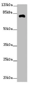 Western blot | All lanes: ZFYVE1 antibody at 2.62μg/ml + Mouse kidney tissue | Secondary | Goat polyclonal to rabbit IgG at 1/10000 dilution | Predicted band size: 88, 41, 86 kDa | Observed band size: 81 kDa