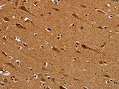 The image on the left is immunohistochemistry of paraffin-embedded Human brain  tissue using NDUFS5 Antibody(NDUFS5 Antibody) at dilution 1/50, on the right is treated with fusion protein. (Original magnification: ×200)Rabbit anti-Human NDUFS5 Polyclonal Antibody