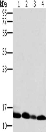 Gel: 10%SDS-PAGE, Lysate: 40 μg, Lane 1-4: Human liver tissue, K562 cells, human fetal brain tissue, Raji cells, Primary antibody: NDUFS5 Antibody(NDUFS5 Antibody) at dilution 1/400, Secondary antibody: Goat anti rabbit IgG at 1/8000 dilution, Exposure time: 5 secondsRabbit anti-Human NDUFS5 Polyclonal Antibody