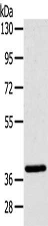 Gel: 8%SDS-PAGE, Lysate: 40 μg, Lane: Mouse brain tissue, Primary antibody: MFF Antibody(MFF Antibody) at dilution 1/200, Secondary antibody: Goat anti rabbit IgG at 1/8000 dilution, Exposure time: 10 seconds