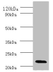 Western blot | All lanes: Interferon alpha-2 antibody at 2μg/ml + Mouse liver tissue | Secondary | Goat polyclonal to rabbit IgG at 1/10000 dilution | Predicted band size: 22 kDa | Observed band size: 22 kDaRabbit anti-Human IFNA2 Polyclonal Antibody